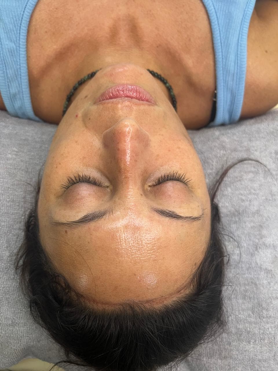 PEELING DE VERANO